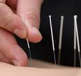 物理治療, 針灸, 運動按摩, 推拿, 揼骨, 穴位按摩, 護脊醫學, massage therapy, manipulative therapy, therapeutic massage, 