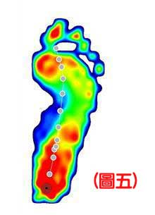 認識不同足患的足底壓力 5