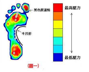 認識不同足患的足底壓力1