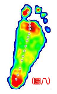 認識不同足患的足底壓力8
